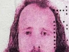 Na foto: homem britânico, 36 anos, que morreu após transplante capilar e tratamento odontológico na Turquia