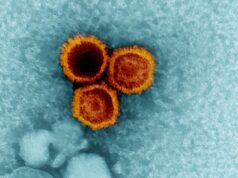 Lúpus pode ser causado pelo vírus Epstein-Barr comum, segundo estudo