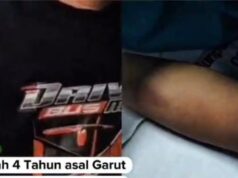 Criança viral de Garut morre em Bandung, suspeita de sofrer violência