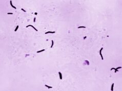 Tuberculose mata 1,23 milhão de pessoas no ano passado, diz OMS | Notícias da Organização Mundial da Saúde