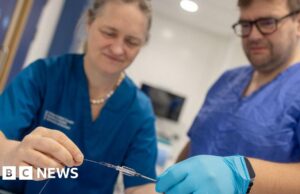 Dundee e cirurgiões dos EUA realizaram a primeira cirurgia de AVC do mundo usando robôs