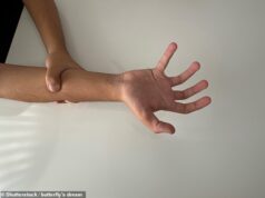 Sofri de uma das doenças mais raras do mundo… apenas 50 pessoas foram diagnosticadas com ela