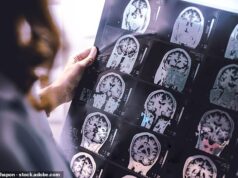 Tratamento de demência que muda vidas ‘dentro de cinco anos’ – cura possível, anunciam especialistas