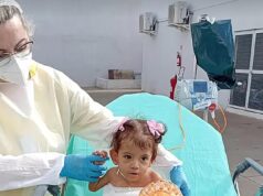 Gêmea siamesa que sobreviveu à operação de maratona para separá-la de sua irmã morre poucos meses depois no Brasil