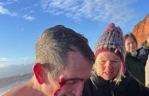 Sobrevivente da natação no dia de Natal diz que ‘foi um erro entrar’ depois de ser resgatado das ‘piores condições de todos os tempos’ em evento festivo que supostamente matou duas pessoas