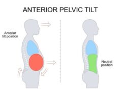 Cientistas dizem que o tamanho da sua bunda pode ser um sinal oculto de autismo