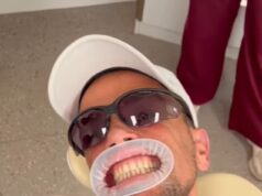 Peter André passa por tratamento de emergência nos dentes após levar chute no rosto de fã que ‘bebeu demais’