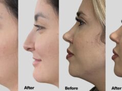 Este soro viral para levantar o maxilar é como um lifting facial em um frasco