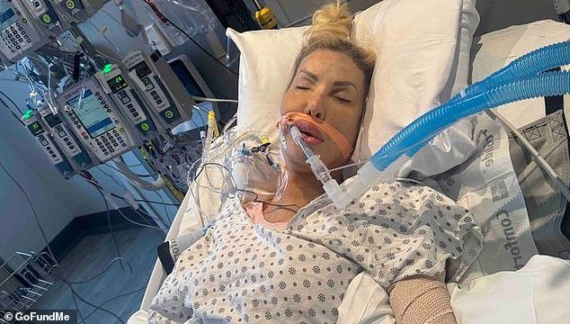 108836821-15844965-Nikki_Exotika_of_90_Day_Fiance_is_recovering_from_another_major_-a-1_1779665319272.jpg