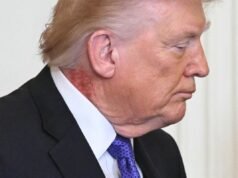 O último relatório de saúde de Trump diz que ele precisa perder peso, mas ignora uma preocupação de saúde digna de nota