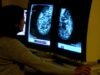 Milhões de pacientes com câncer de mama poderiam evitar a quimioterapia com um novo teste genômico
