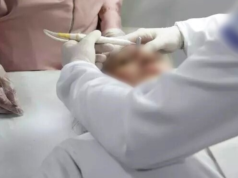 CFM autoriza uso de fenol com regulamentação rígida para médicos