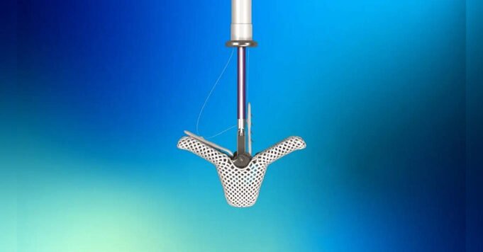 abbott-launches-triclip-in-india-expanding-minimally-invasive-options-for-treating-leaky-tricuspid-valve.jpg