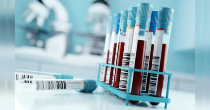 blood-test-could-help-detect-signs-of-alzheimers-disease-decades-before-symptoms-study.jpg