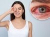 Um oftalmologista revela 4 razões pelas quais você não deve esfregar os olhos