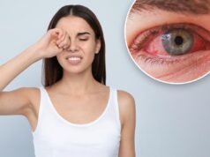 Um oftalmologista revela 4 razões pelas quais você não deve esfregar os olhos