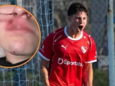 Nariz quebrado e duas horas de espancamento: a denúncia brutal de violência de gênero contra jogador do Independiente